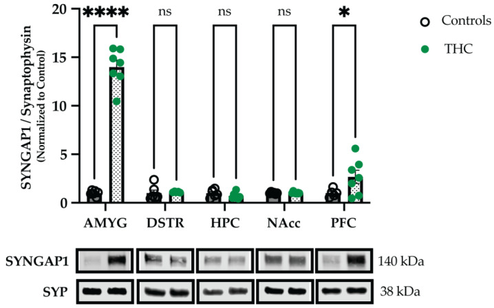 Exposure to THC in adolescence affects levels of SYNGAP1 in the amygdala and PFC. Male rats were exposed to Δ9-tetrahydrocannabinol (THC) or vehicle (i.e., controls) in mid-adolescence/puberty (PND 42–52) and synaptosomal fractions were extracted from five different brain regions in late adolescence (PND 64) on drug abstinence day 12. Western blotting analyses showed significant upregulation in synaptic levels of SYNGAP1 in the amygdala and prefrontal cortex of THC-treated animals (N = 6–7 animals per group; N = 1 outlier in DSTR and N = 1 outlier in PFC). Graph data are presented as mean ± SEM. Representative Western blots are shown below the graphs, with the approximate molecular weights of observed band sizes indicated to the right. AMYG, amygdala; DSTR, dorsal striatum; HPC, hippocampus; kDa, kilodaltons; NAcc, nucleus accumbens; PFC, prefrontal cortex. * p < 0.05, **** p < 0.0001, and ns = not significant.