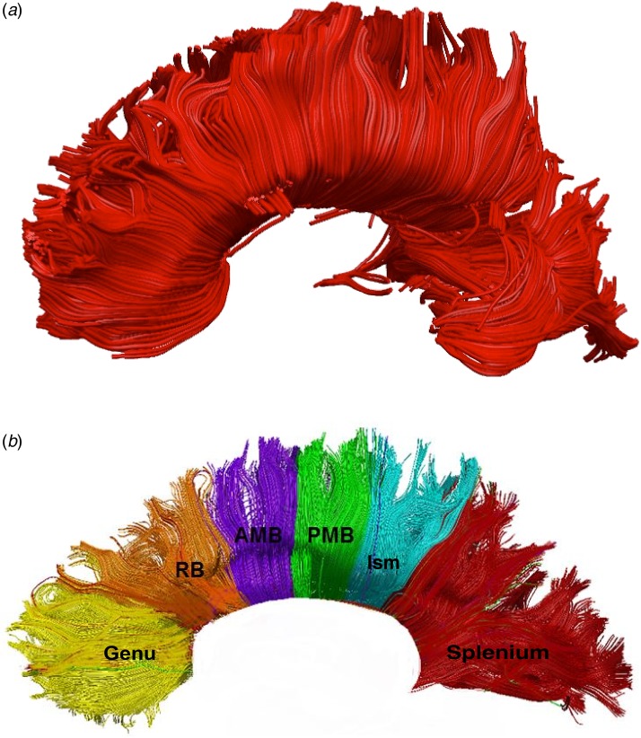 Corpus callosum tract: whole (a) and segmented (b). Regions of interest as defined according to Witelson (1989) subdivisions. RB, Rostral body; AMB, anterior mid-body; PMB, posterior mid-body; Ism, isthmus. For a colour figure, see the online version.