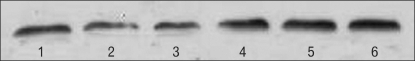 Representative Western blotting for cannabinoid type 1 receptor (CB1R) in distal colon, proximal colon and distal small intestine. The band of 1, 2 and 3 represent Western blotting for CB1R in distal colon, proximal colon and distal small intestine from the rats of the sham partial restraint stress (PR) group; 4, 5 and 6 represent Western blotting for CB1R in distal colon, proximal colon and distal small intestine from the rats of the PR group.