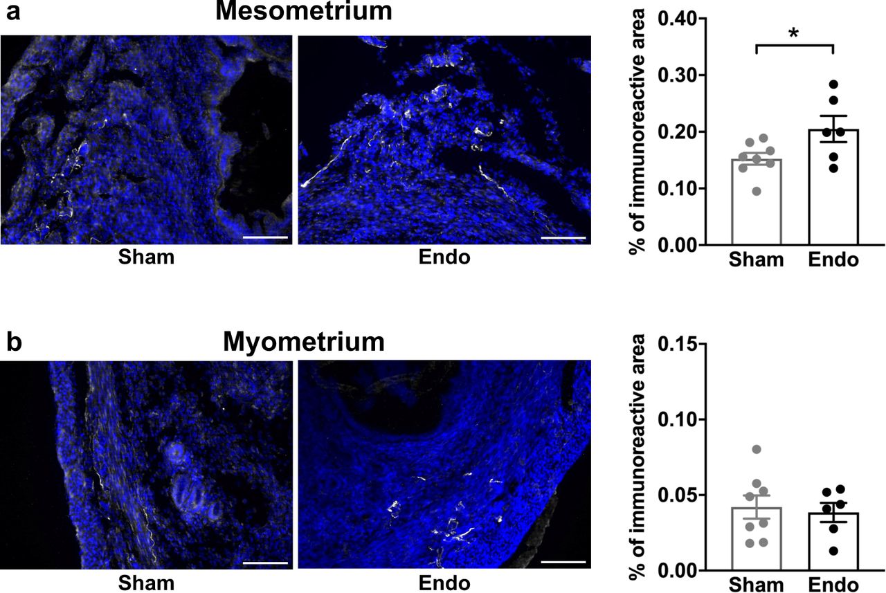 Density of beta-III tubulin-labeled fibers in uteri of endometriosis and sham mice.(a) The percentage of immunoreactive area of the mesometrial aspect of the uterus was higher in endometriosis mice. (b) The percentage of immunoreactive area of myometrium did not differ between groups. Blue is DAPI and white is β-III tubulin. Scale bar = 100 μm. Error bars are mean ± SEM. Student t-test. *p<0.05 vs sham. Endo, endometriosis. Figure 1 - Source Data.