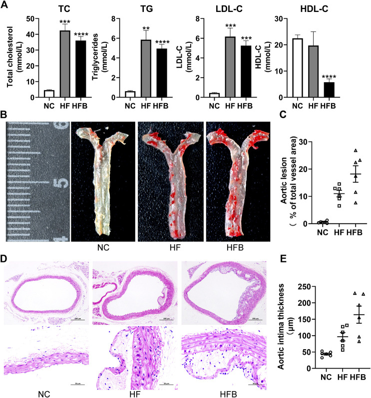 Evaluation of atherosclerosis formation in ApoE−/− mice fed high-fat diets. (A) Plasma lipid levels in mice, from left to right: total cholesterol (TC), triglycerides (TG), low-density lipoprotein cholesterol (LDL-C), and high-density lipoprotein cholesterol (HDL-C), respectively. (B) Gross staining of oil red O in the thoracic aorta of mice (at the end of the 16th week). (C) Statistical map of thoracic aortic plaque area in mice. (D) HE staining of mice aortic arch (at the end of the 16th week; ×100, 100-fold; ×400, 400-fold). (E) Statistical maps of intima-media thickness (IT) in mice. n = 6, mean ± SEM. *, p < 0.05; **, p < 0.01; ***, p < 0.005; ****, p < 0.001; vs. NC.
