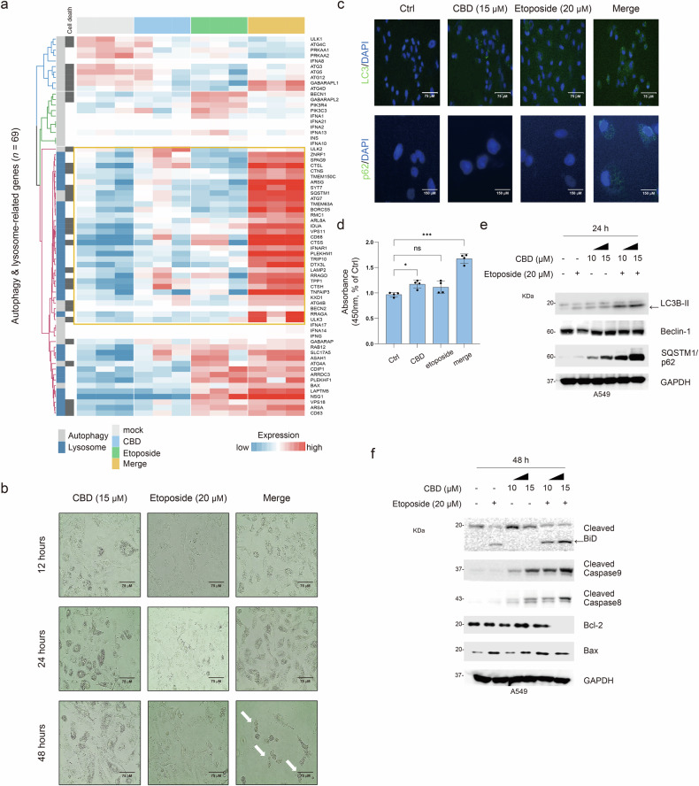 Effect of combination treatment with CBD and etoposide on autophagic cell death.a A supervised clustering heat map displaying the autophagy-, lysosome- and cell-death-related genes (n = 69) across the groups with each relevant gene indicated. b Morphological features of autophagic cell death in A549 cells treated with CBD (15 μM), etoposide (20 μM) and their combination (merge) at 12, 24 and 48 h. White arrows indicate autophagic cell death. c Confocal immunofluorescence of LC3B (green), SQSTM1/p62 (green) and DAPI (blue) in A549 cells using the EVOS M5000 imaging system. d A bar plot showing the absorbance of MDC, indicating the autophagic traits in A549 cells treated with CBD (15 μM), etoposide (20 μM) and their combination (merge) at 24 h. Statistical significance is indicated (versus Ctrl, *P < 0.05 and ***P < 0.001; Student’s t-test). e Western blot analysis of LC3B, Beclin and SQSTM1/p62, normalized to GAPDH. f Western blot of cleaved BiD, caspases 8 and 9, Bcl-2 and Bax, normalized to GAPDH.
