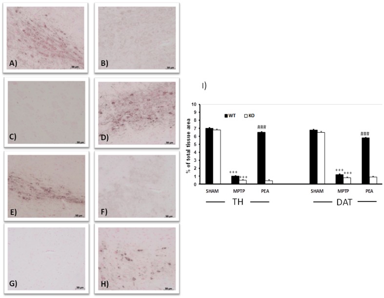 Effect of PEA on TH and DAT expression in SN.An important loss of TH-positive cells was observed in MPTP-injected animals at 8 days after intoxication in PPARαWT (B, see densitometric analysis in I). The absence of PPARα gene in PPARαKO significantly increases the loss of TH-positive cells after MPTP (C and I). The absence of PPARα gene alone did not modify the presence of TH-positive cells in sham animals (A). PEA reduced in PPARαWT mice the MPTP-induced loss of TH-positive neurons in the SN (D and I). Moreover, MPTP injection produced a strong loss of DAT expression at 8 days (F and I). The absence of PPARα gene increases the loss of DAT positive cells (G and I). In panel H and I, PEA treatment ameliorated in PPARαWT mice the sever reductions in levels of DAT. PEA failed to rescue DAT and TH induced by MPTP injection in PPAR-α KO mice.
