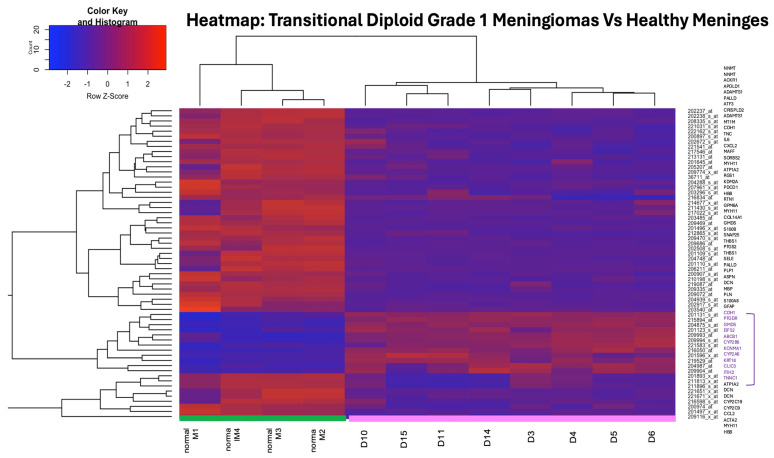 Hierarchical clustering heatmap of DEGs. Heatmap showing hierarchical clustering of DEGs between DT-G1 meningiomas and healthy meninges. Normalized expression values were clustered using average linkage, and the colour gradient represents relative expression levels. Healthy samples (green) and meningiomas (pink) form two clearly separated clusters, highlighting distinct tumour-associated transcriptional profiles.