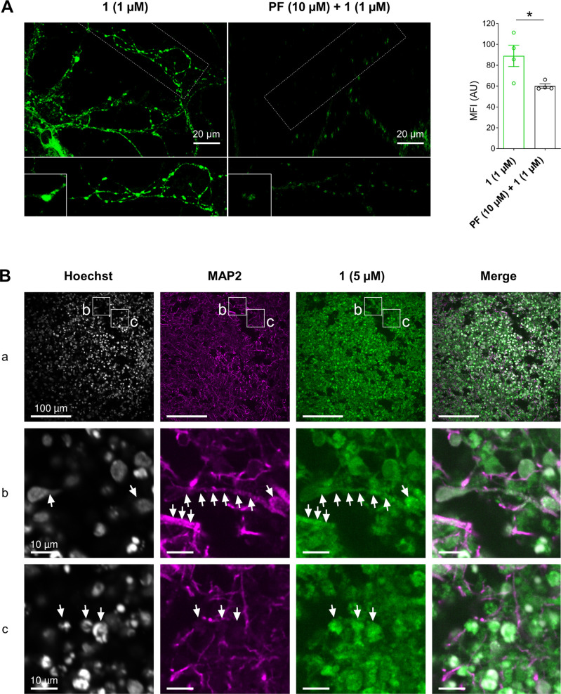 Confocal imaging of primary neuronal cultures and human induced pluripotent stem cell (hiPSC)-derived brain organoids using covalent probe 1. (A) Left: confocal images of the live dissociated primary hippocampal neuron culture at day-in vitro 14–21. Cells were treated with 1 (1 μM) at 37 °C for 15 min; negative controls were treated with 10 μM MAGL inhibitor PF for 2 h prior to MAGL labeling. Neuronal processes (dashed line) and potential synapses (insets) are highlighted; right: quantification of mean fluorescence intensity (MFI) of the signal of 1 in neurons with or without 10 μM PF pretreatment (open circles represent n = 4 images per condition, two-tailed Student t test). (B) Representative confocal images of human induced pluripotent stem cell (hiPSC)-derived brain organoids incubated with 5 μM probe 1 for 2 h after 83 d of organoid maturation, subsequent fixation, cryosectioning, and staining of nuclei (Hoechst) and neurons (MAP2). Subpanel row (a): overview with an indication of regions for subpanels rows (b, c). Arrows indicate several MAP2-positive neurons (subpanel b) and non-neuronal cells, MAP2-negative; subpanel (c) with signal for probe 1.