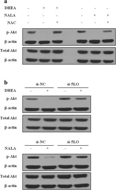 5-LO-induced ROS mediates the decrease of Akt activity by DHEA and NALA. a SNU-1041 cells were treated with DHEA or NALA (40 μM) plus NAC (1 mM). At 24 h, cells were harvested and applied to western blotting. b Cells were transfected with the indicated siRNA (200 nM). Forty-eight hours later cells were treated with DHEA or NALA (40 μM). After additional 24 h, cells were harvested and applied to western blotting (si-NC was used for control). The membranes were incubated with anti-β-actin plus anti-p-Akt or anti-pan-Akt for 2 h at room temperature (β-actin was used to show an housekeeping gene). Data are presented as a representative of 3 separate experiments