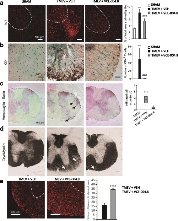 VCE-004.8 significantly reduces microglial reactivity and infiltration of inflammatory cells and preserves myelin structure in TMEV-infected mice. Cross-sectional images of thoracic–lumbar spinal cord cross-sections of 30 μm thick, in which immunofluorescence with anti-Iba1 (a), anti-CD4 (b), H-E (c), cryomyelin (d), and neurofilament H staining (e) immunohistochemistry was performed. Treatment with VCE-004.8 reduces the number of CD4+ T cells, cell infiltrates (c, arrows), and a significant decrease in microglial reactivity (a). The quantifications are shown as means ± SEM, and significance was determined by Kruskal–Wallis non-parametric test. ***p < 0.001 vs Sham; ##p < 0.01, ###p < 0.001 vs TMEV + VEH. Scale bar: 150 μm (a), 100 μm (c and e). ***p < 0.001 unpaired two-tailed Student’s t test (d)