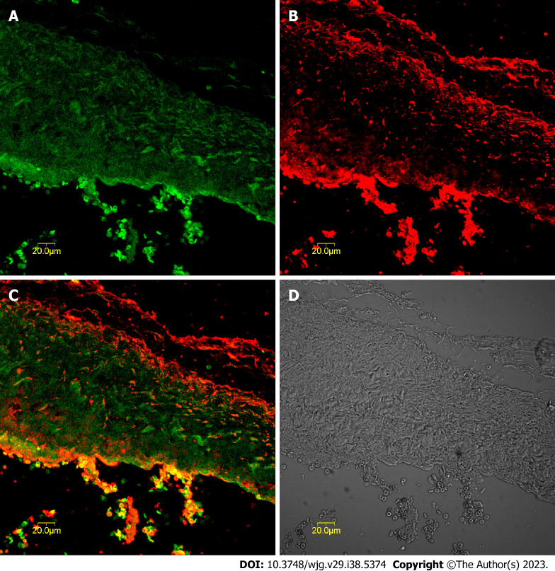 Expression of tyrosine kinase receptor and cholecystokinin-A receptors in gallbladder tissue sections determined by immunofluorescence. A: Tyrosine kinase receptor-positive cells (green) in the muscularis layer of the gallbladder; B: Cholecystokinin-A receptor-positive cells (red) were mainly located in the muscularis layer of the gallbladder; C: Synthetic micrographs of A and B; D: Phase-contrast micrograph of A and B.