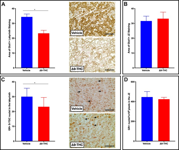 Exposure to 3 mg/kg Δ9-THC during gestation leads to decreased GLUT1 and GR exclusively in the labyrinth zone at E19.5 compared to vehicle treatment. (A) Percentage of GLUT1 area and representative IHC for GLUT1 in the labyrinth layer of placentae from vehicle and Δ9-THC exposed dams. (B) Percentage of GLUT1 area junctional zone. (C) Percentage of GR area and representative IHC for GR in the labyrinth layer of placentae from vehicle and Δ9-THC exposed dams. (D) Percentage of GR area in the junctional zone. For labyrinth layer, 6-images/placenta were taken at 40x, while for junction zone 6-images/placenta were taken at 10x. Graphs present mean ± SEM, Significance; Student’s t-test (*P < 0.05). Scale bars = 30 uM. Arrows indicate positive staining for GR in (C).