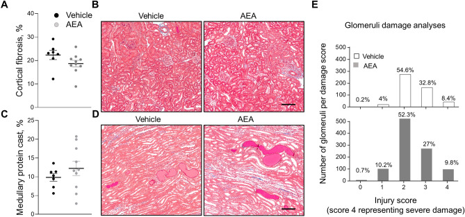 Development of the kidney injury after chronic exposure to a low dose of AEA (0.05 mg/kg) or vehicle in Dahl SS rats fed a high salt diet. (A, C) Summary graphs of cortical fibrosis (A) and the medullary protein cast area (percent total kidney area) (C). Protein cast analysis was performed using a color thresholding method using Metamorph software. Fibrosis was assessed using color deconvolution in the Fiji image application (ImageJ 1.47v, NIH). (B, D) Representative images of kidney tissue stained with Masson’s trichrome (× 10 magnification). Scale bar is 150 µm. (E) Glomerular injury score (0–4, where 0 = no damage) assessed by semiquantitative morphometric analysis. Numbers of glomeruli per score are shown on the y-axes. The percentage of glomeruli within the selected score range defined from cumulative distribution is shown above the corresponding column. n ≥ 5 rats per group, N ≥ 500 glomeruli per group. Statistical analysis consisted of a Kolmogorov–Smirnov test to identify significant differences between the groups (OriginPro 9.0) with a P > 0.05, distributions were not significantly different.