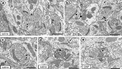 Electron micrographs showing D2R-immunogold labeling in axon terminals (D2-t) within the Acb shell of mice having 1 h previously received quinpirole (QNP) or saline. Images in a and b provide qualitative evidence for increased plasmalemmal (white block arrows) D2R-immunogold labeling in axon terminals (D2-t) forming asymmetric, excitatory-type synapses with dendritic spines. These terminals are without detectable CB1R-immunoperoxidase labeling, as is the terminal in c which forms a symmetric synapses with and unlabeled dendrite (U-de). In contrast, the inhibitory-type terminals (D2/CB1-t) seen in d and e contain both D2R-immunogold and CB1R-immunoperoxidase labeling with no apparent treatment-specific differences in the plasmalemmal D2R distribution. The dually labeled terminal forms a synapses with a D2R-labeled soma (D2-soma) in d and an unlabeled soma (U-soma) in e. Small black arrows indicate cytoplasmic and block arrows indicate plasmalemmal D2R-immunogold particles. Microscopic scale bars = 500 nm