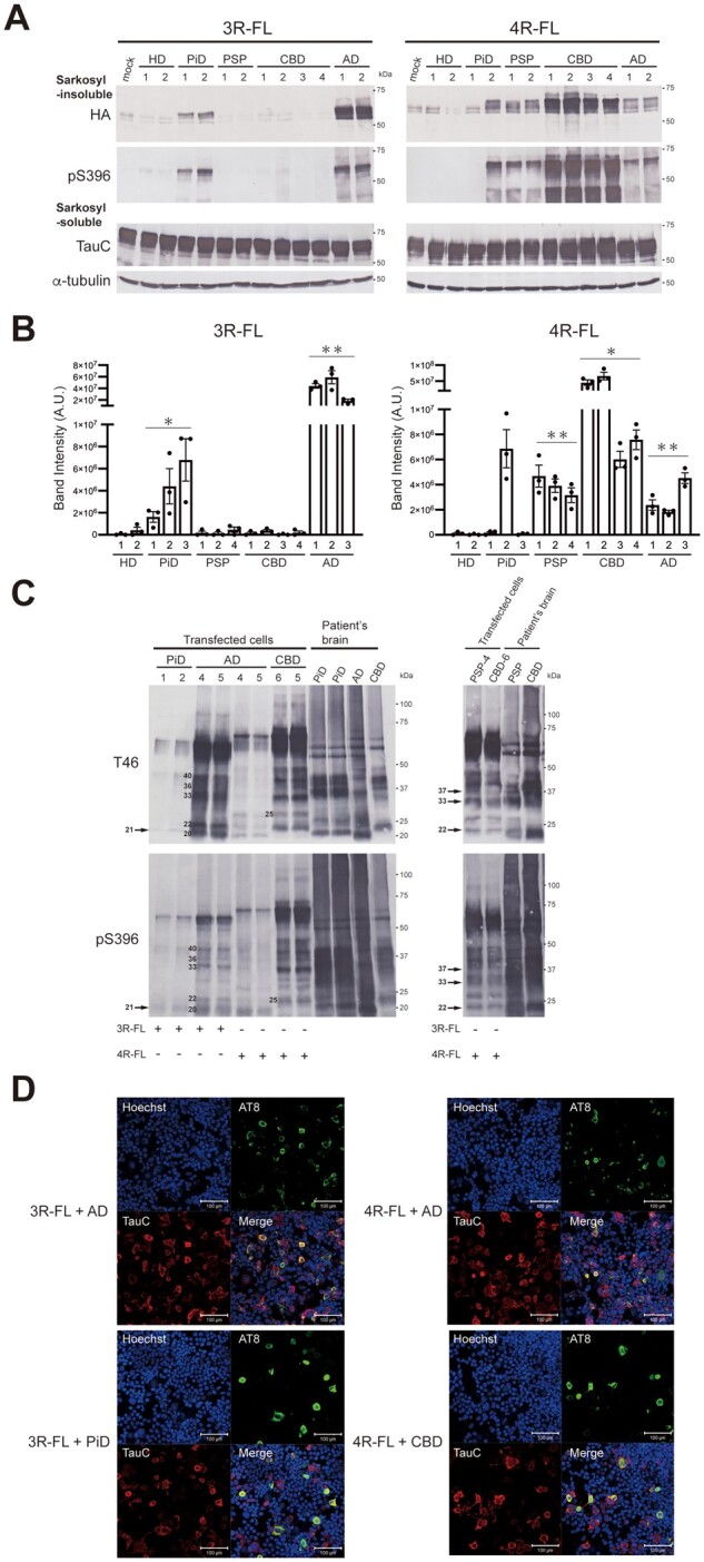 Seeded tau aggregation induced by patient-derived tau strains in SH-SY5Y cells expressing full-length tau. (A) Sarkosyl-insoluble fractions extracted from patients’ brains (1 μl) were introduced into SH-SY5Y cells transiently expressing HA-tagged wild-type human tau 3R1N (left) or 4R1N (right). Immunoblot analysis of sarkosyl-insoluble fractions and sarkosyl-soluble fractions extracted from mock-transfected cells, and cells transfected with sarkosyl-insoluble fractions from two Huntington’s disease cases, two PiD cases, two PSP cases, four CBD cases and two Alzheimer’s disease cases. Insoluble tau was detected with anti-HA and pS396 antibodies. Total tau was detected with TauC antibody. The tau concentrations of sarkosyl-insoluble fractions derived from human brains are shown in Supplementary Table 2. Full-length blots are presented in the Supplementary material. (B) Quantification of the band intensities of the immunoblots with anti-HA antibody shown in A and Supplementary Fig. 2B. The results are expressed as means ± standard error of the mean (SEM) (n = 3). *P < 0.01; **P < 0.001; Welch’s modified t-test against the value of Huntington’s disease. (C) Immunoblot analyses of sarkosyl-insoluble fractions prepared from transfected SH-SY5Y cells and patients’ brains. C-Terminal tau fragments were detected with T46 (top) and pS396 (bottom) antibodies. Full-length blots are presented in the Supplementary material. (D) SH-SY5Y cells introduced with AD-, PiD- and CBD-tau seeds were fixed and immunostained with AT8 (green) and TauC (red) antibodies. Scale bar = 100 μm.