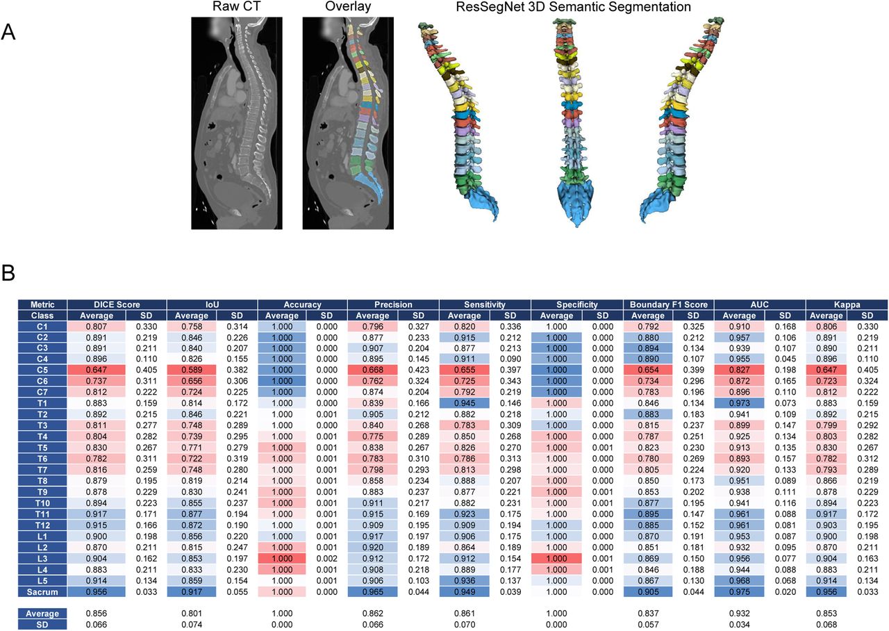 SpineCT-ResSegNet spine segmentation model predictions and segmentation metrics.(A) Example of segmentation results with the spineCT-ResSegNet, a trained MONAI-Label native model, in both 2D and 3D visualizations. Vertebrae are color coded. The entire human spine is represented in the image: cervical spine (C1-C7), thoracic spine (T1-T12), Lumbar spine (L1-L5) and sacrum. (B) Validation metrics for spineCT-ResSegNet spine segmentation model, based on the prediction of 108 cases. Color encodes the accuracy of segmentation class predictions. Blue indicates high similarity to the ground truth, while red represents increasing deviation from the actual values.