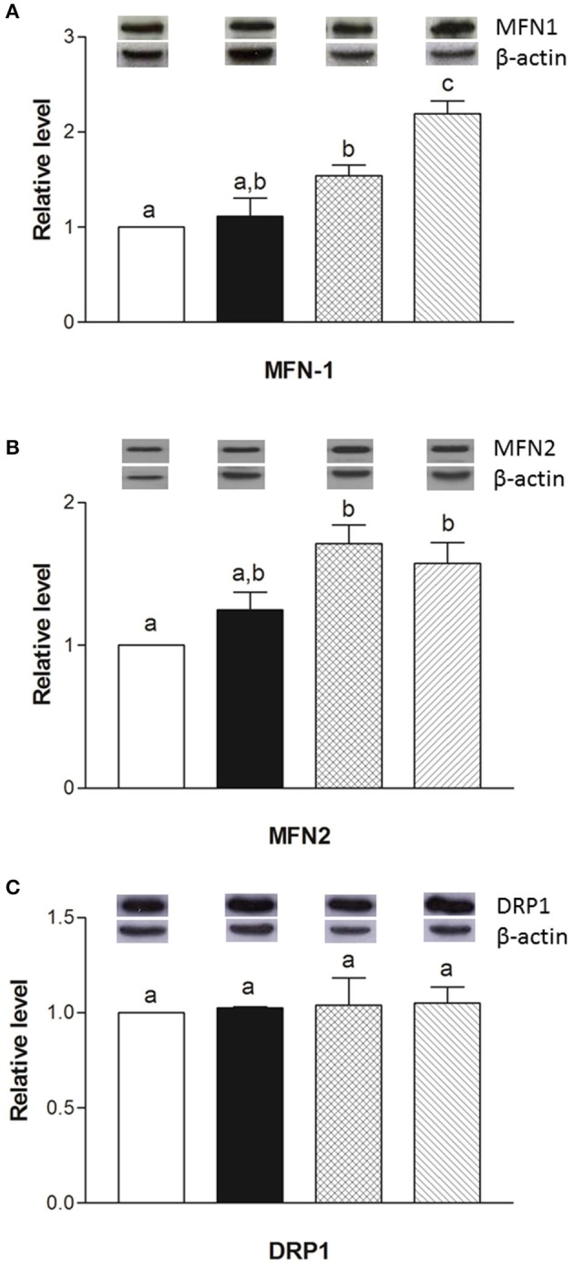 Effects of oral administration of human, cow, and donkey milk on the protein levels of MFN1, MFN2, and DRP1. Results of the quantitative Western blot analyses for MFN1 (A), MFN2 (B), and DRP1 (C) were summarized. Protein levels of MFN1, MFN2, and DRP1 assessed in densitometry were normalized to the level of β-actin. Insets: representative immunoreactive signals for MFN1, MFN2, DRP1, and β-actin. Data are presented as means ± SEM from n = 7 animals/group. Labeled means without a common letter differ (P < 0.05).