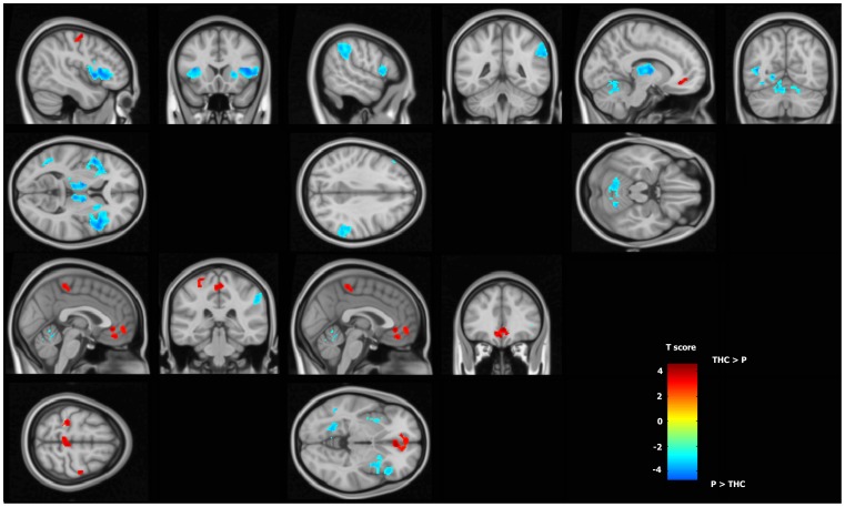 Effect of THC smoking on brain function during the visuo-motor tracking task.When comparing the THC and the Placebo sessions, fMRI BOLD response changes in the Active tracking task vs Passive condition reveal major alteration of brain networks. Hot colour bar represents regions showing an increase in BOLD signal after the cannabis smoking. Cold colour bar represents the opposite contrast. Maps are thresholded at p<0.005 and k>40 and superposed on a standard brain in the MNI (Montreal Neurological Institute) space.