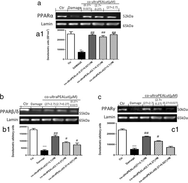 Effect of co-ultraPEALut on PPARα, PPARβ/δ and PPARγ expression. PPARα, PPARβ/δ and PPARγ expression were evaluated by western blot analysis. The mechanical damage induced a decrease in (a,a1) PPARα , (b,b1) PPARβ/δ and (c,c1) PPARγ expression compared to the control group. Co-ultraPEALut pretreatment at the three concentrations significantly restored the levels of both PPARα and PPARβ/δ; PPARγ expression was restored by co-ultraPEALut 0.0009 g/l (containing PEA and Lut at 2.7 and 0.27 μM, respectively) and 0.009 g/l (containing PEA and Lut at 27 and 2.7 μM, respectively). **P <0.01 and ***P <0.001 versus Ctr; #P <0.05 and ##P <0.01 versus Damage. Ctr, control; Lut, luteolin; PEA, palmitoylethanolamide; PPAR, peroxisome proliferator-activated receptor.