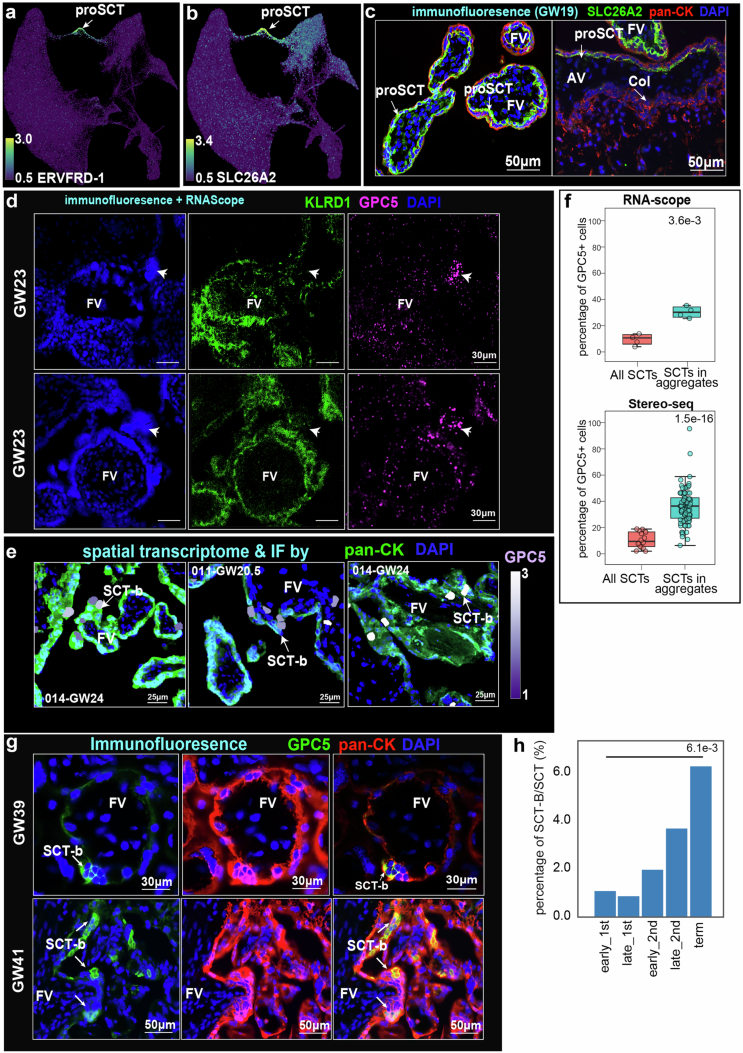 Molecular and spatial characterization of syncytiotrophoblast subtypes.(a-b) snRNA-seq UMAPs showing ERVFRD-1 (syncytin-2) (a) and SLC26A2 (b) expression specific to progenitor SCTs (proSCT). (c) Immunolocalization of SLC26A2 (green) and pan-CK (red) in placental villi (left) and basal plate (right) marking proSCTs in floating villi. FV, floating villi; AV, anchoring villi; col, cell column (GW19). Representative images from FVs and AVs from one of three replicates were shown. (d) Joint RNAscope FISH for GPC5 (magenta) and immunostaining for CD94 (green) in FV from two GW23 placentas as biological replicates, identifying GPC5+ SCT-b cells enriched in syncytial aggregates/knots and CD94+ SCT-a cells along the trophoblast basement membrane. (e) Representative zoomed views from spatial transcriptomes showing GPC5+ SCT-b localization within syncytial aggregates/knots (011-GW21.5 and 014-GW24), with pan-CK (green) and CD31 (red) co-immunostaining. (f) Quantification of GPC5+ SCTs in syncytial aggregates vs. the entire syncytium by RNAscope (left) and Stereo-seq (right). Box plots, center line=median, box=IQR (25th-75th percentile), minima/maxima=lower/upper whisker (0.5×IQR) endpoints; P values, two-tailed Student’s t test. (g) Immunolocalization of GPC5 in two term placentas (GW39, GW41) showing preferential cytoplasmic localization of SCT-b cells within syncytial aggregates/knots. (h) Increased proportion of the SCT-b subtype with advancing gestation. P values, two-tailed Fisher’s exact test with Benjamini-Hochberg correction. Source data