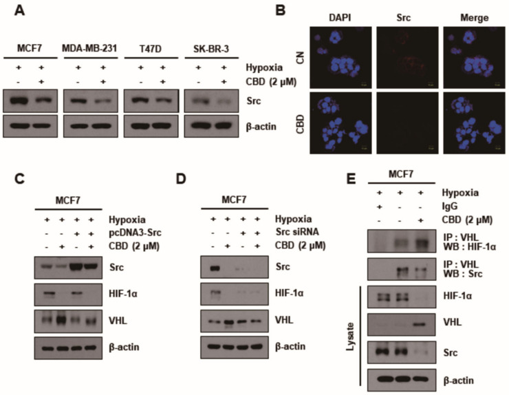 Src regulates the HIF-1α expression via ubiquitination of VHL. (A) MCF7 cells were treated with or without CBD (2 μM) in hypoxia conditions. The expression level of Src detected by Western blotting. β-actin was used as a loading control. (B) Immunofluorescence images showed the expression of Src in MCF7 cell lines. (C) MCF7 cells were transiently transfected with pcDNA3-Src plasmid or (D) Src siRNA and then treated in both groups under hypoxia. The cells were then lysed, and Western blotting was performed for Src, HIF-1α, VHL, and β-actin. β-actin was used as a loading control. (E) The interaction between VHL and HIF-1α or Src was assessed by co-immunoprecipitation assay. Cells were treated with CBD (2 μM) in hypoxia conditions. Cell lysates were immunoprecipitated with the IgG and anti-VHL antibody, followed by immunoblotting for HIF-1α, Src, total HIF-1α, VHL, and β-actin. β-actin was used as a loading control. CBD; cannabidiol, CN; control.