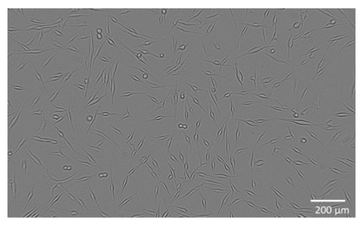Melanoma cells WM-266-4 during cultivation.