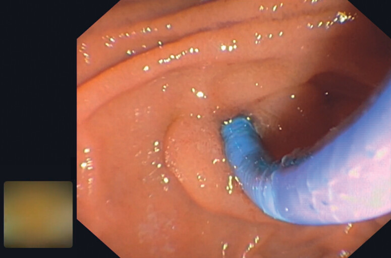 PMC11996019 – FI_Ref192766633