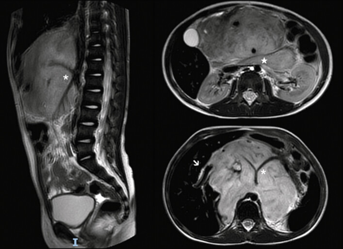 PMC12324853 – FI2024120778cr-1