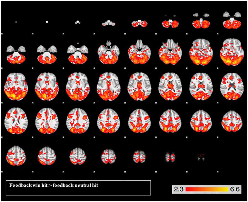 PMC7745615 – fig3-0269881120944148