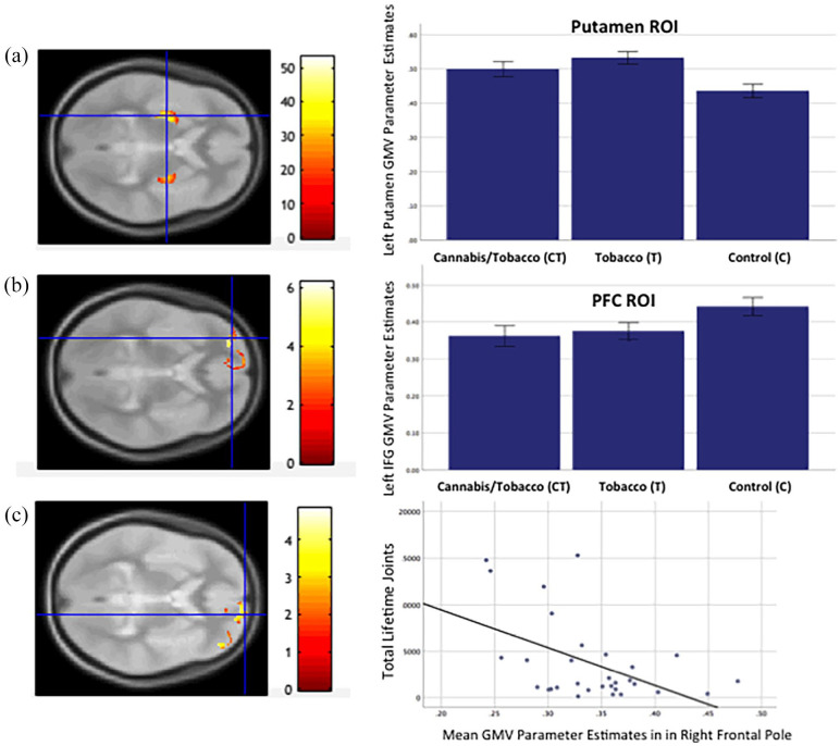 PMC9716493 – fig1-02698811221117523