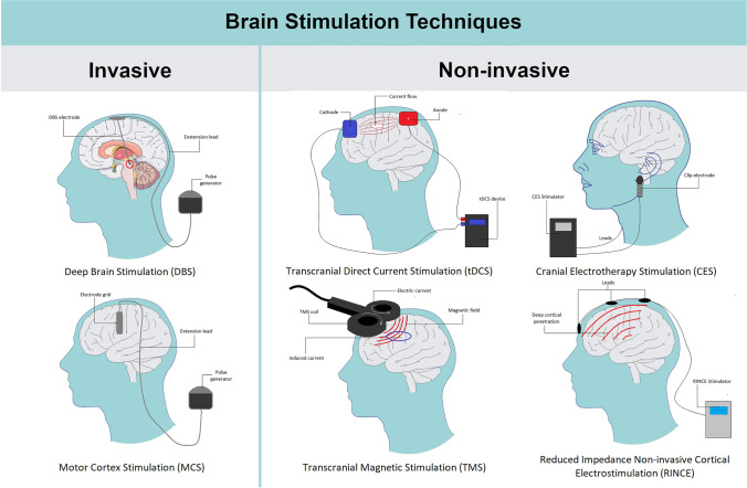 PMC10227133 – Fig2