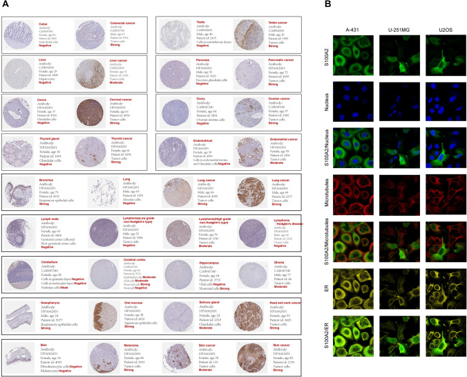 PMC11058162 – Fig6