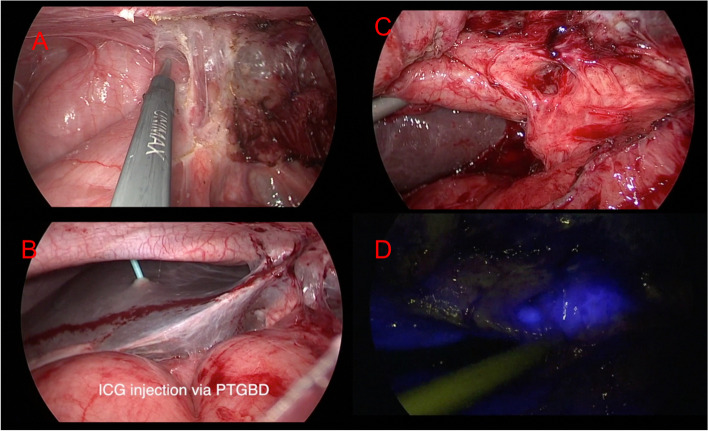 PMC10349467 – Fig1