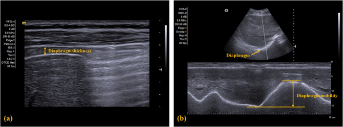 PMC12486538 – Fig3