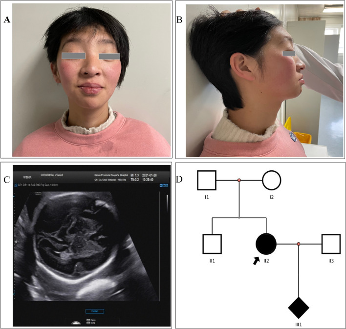 PMC10165755 – Fig1