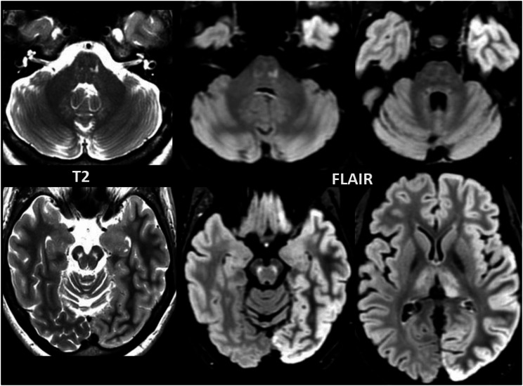 PMC11421175 – Fig4