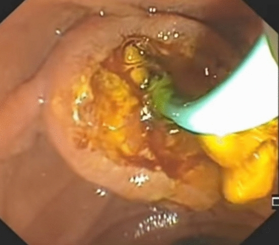 PMC11541338 – Fig3