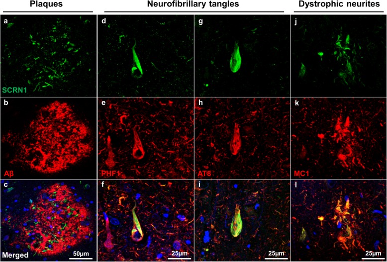 PMC6892024 – Fig2