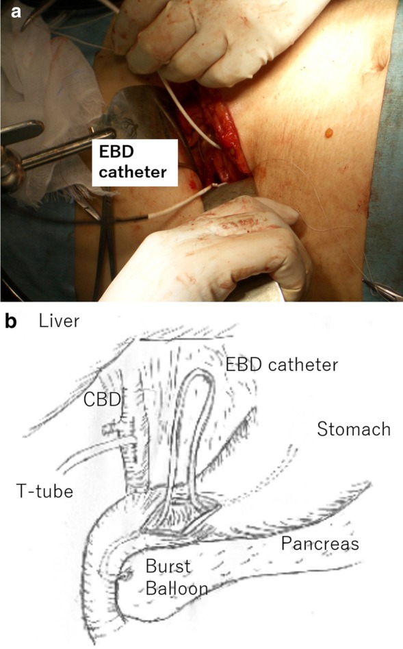 PMC7532242 – Fig4
