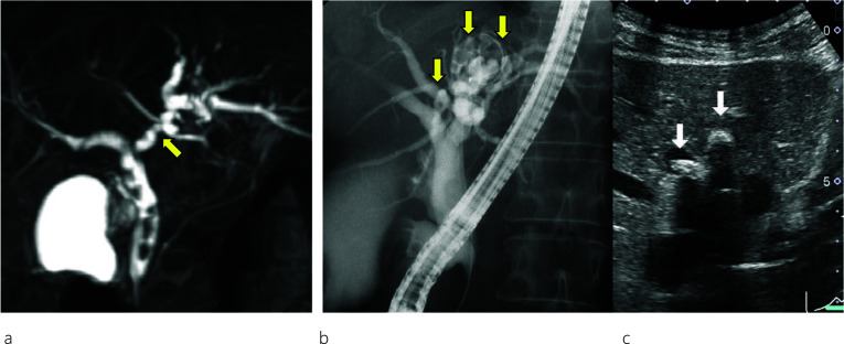 PMC11166617 – Fig1