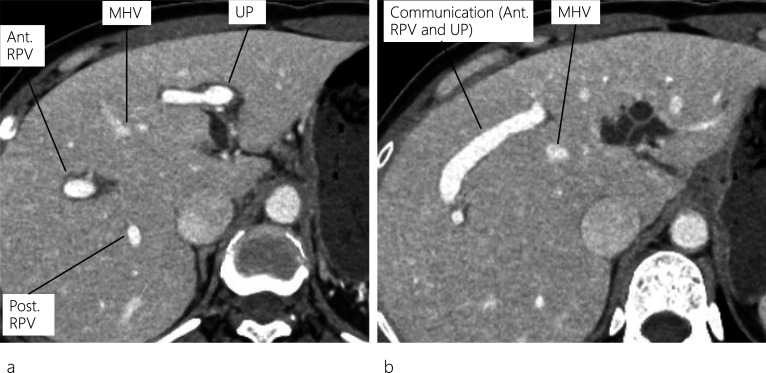 PMC11166617 – Fig2