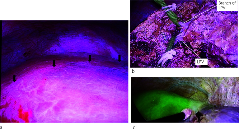 PMC11166617 – Fig4