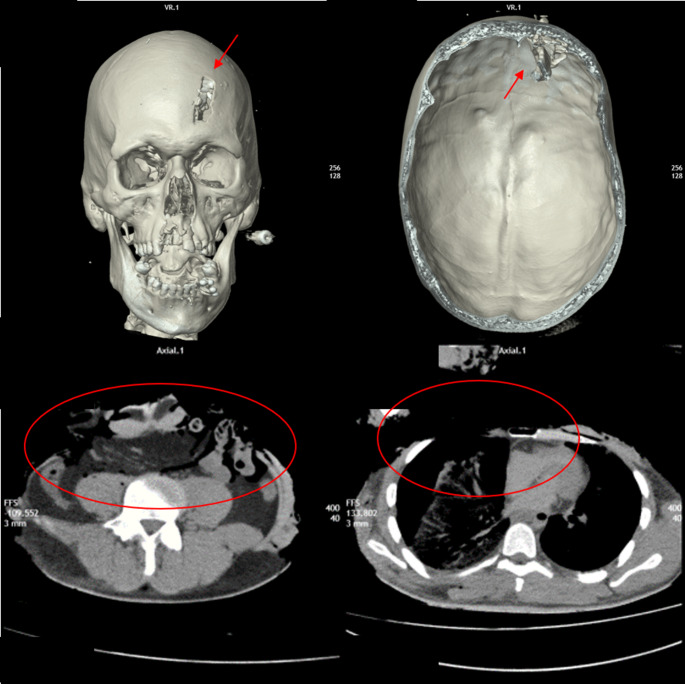 PMC12532682 – Fig2