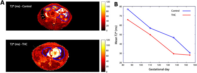 PMC9691736 – Fig3