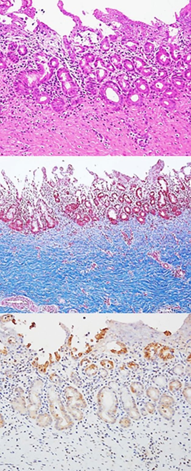 PMC10156684 – Fig6