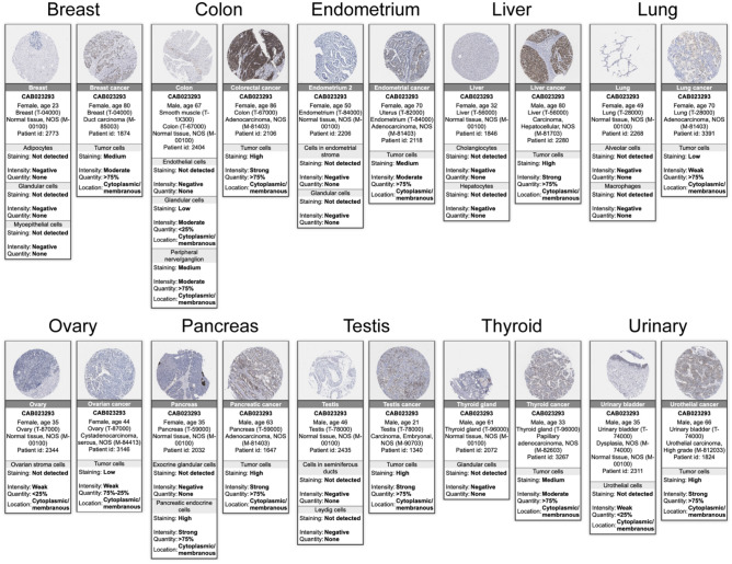 PMC11061125 – Fig4
