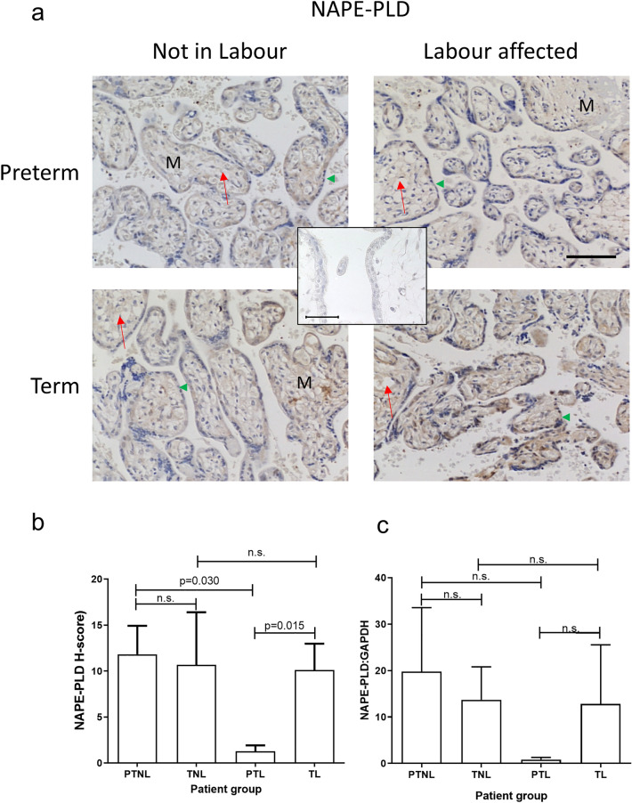 PMC10700443 – Fig4