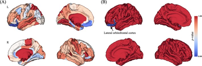 PMC12061635 – adb70040-fig-0003