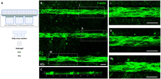 PMC12147984 – adhm202401804-fig-0002