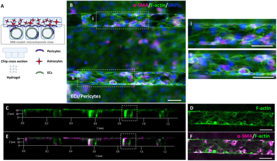 PMC12147984 – adhm202401804-fig-0003