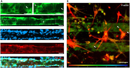 PMC12147984 – adhm202401804-fig-0004