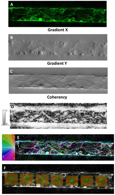 PMC12147984 – adhm202401804-fig-0005