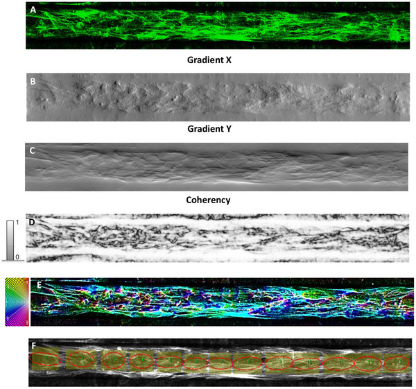 PMC12147984 – adhm202401804-fig-0006